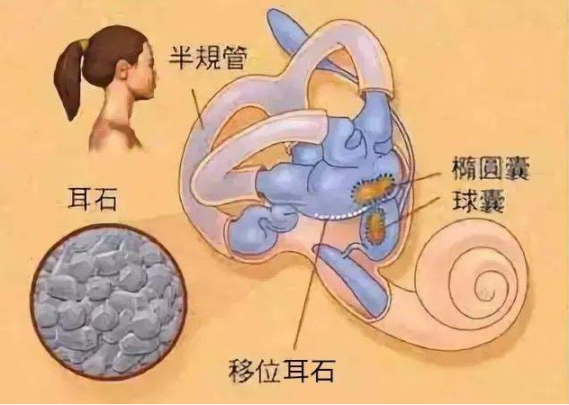 ʯYô(f)λʯY